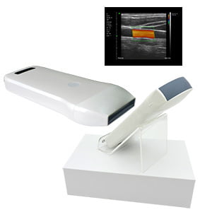 ULTRASONIDO WIFI COLOR DOPPLER